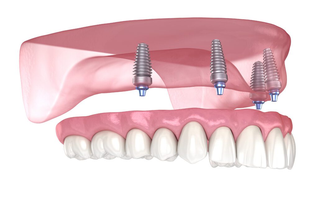 Temecula modern dentistry